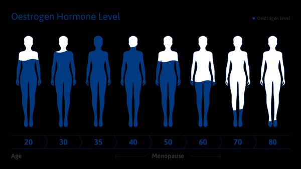 Истории белорусок, которые не желают стареть Истории белорусок, которые не желают стареть