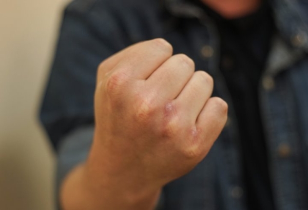 Мужчина избивал жену, находящуюся в отпуске по уходу за ребенком. Случай в Брестской области