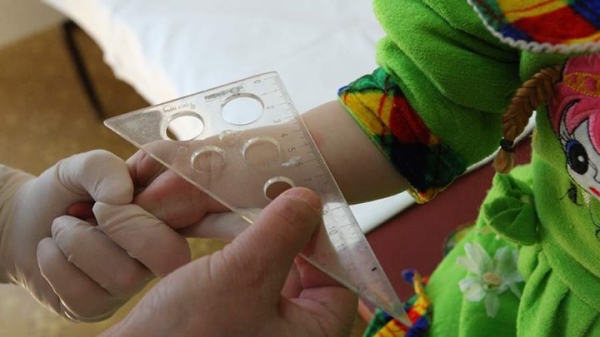 Можно ли мочить пробу Манту?